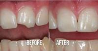 Grove City Dental image 11